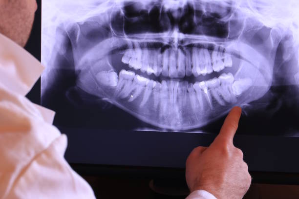 Best Emergency Treatment for Oral Infections in Fairway, KS