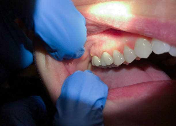Best Emergency Denture Repair in Fairway, KS