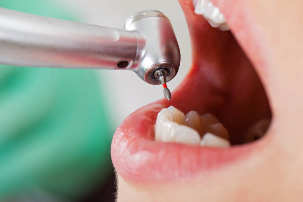 Best Dental Abscess Treatment in Fairway, KS
